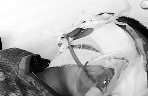 被挖眼男童回忆被害一刻:那个女人说跟我走 