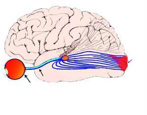 义眼植入手术如何运作 带你看人工视觉系统助