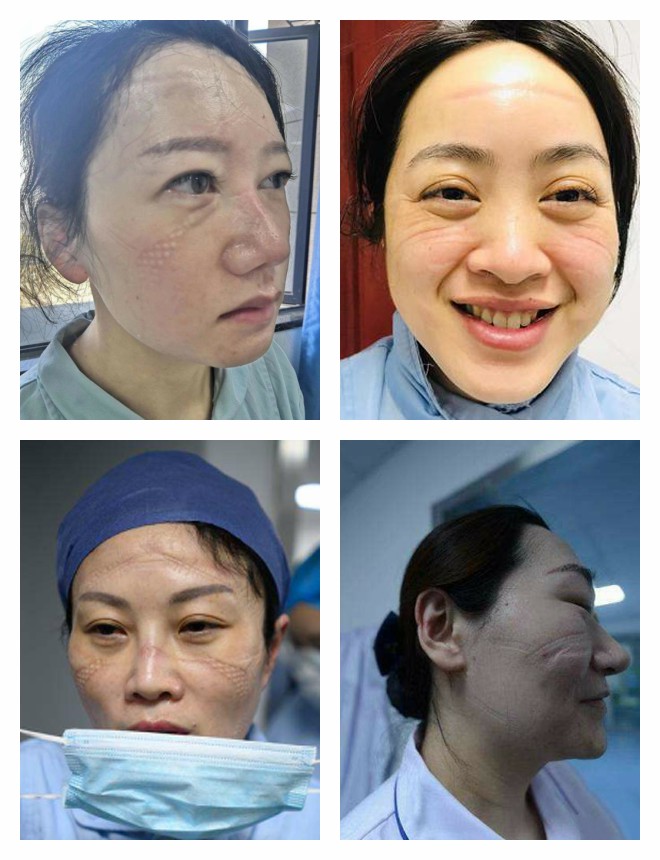 暖心闻|战“疫” 英雄的战“容”与战“姿”