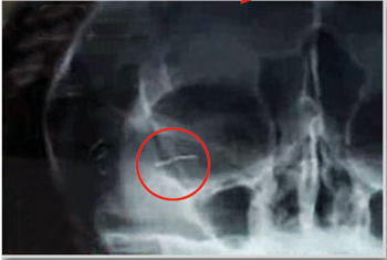 9元金丝卖12000元 br 广深金丝美容骗局曝光