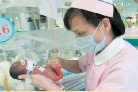 孕期25周早产男婴体重800克 仅成人巴掌大小