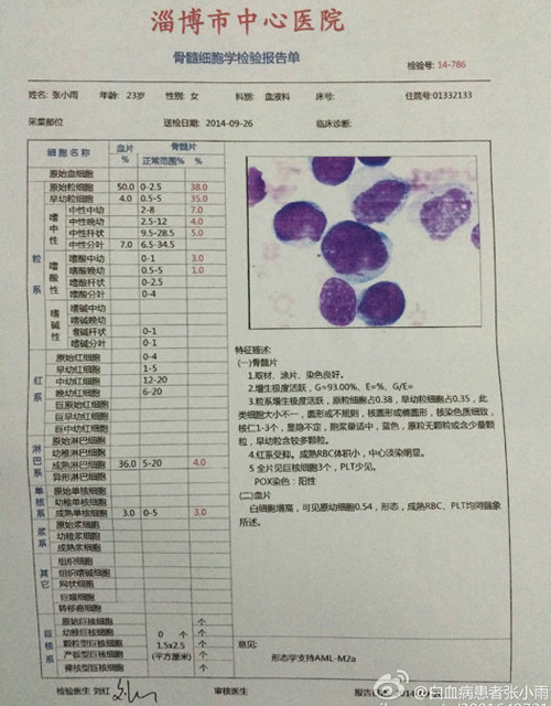 23岁女孩张小雨笑对血癌 做死神吓不倒的"逗比"