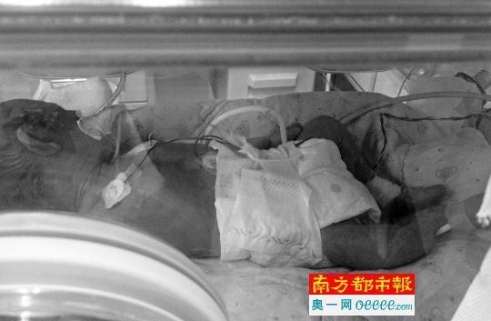 护士烧伤新生儿院方隐瞒实情 家属6天后才知▏