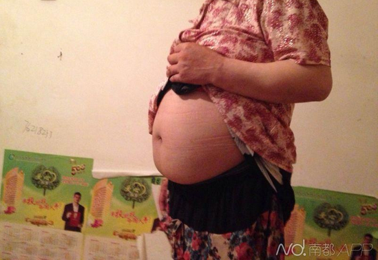 四川怀孕精神病女子或今日引产 获补助2万元(