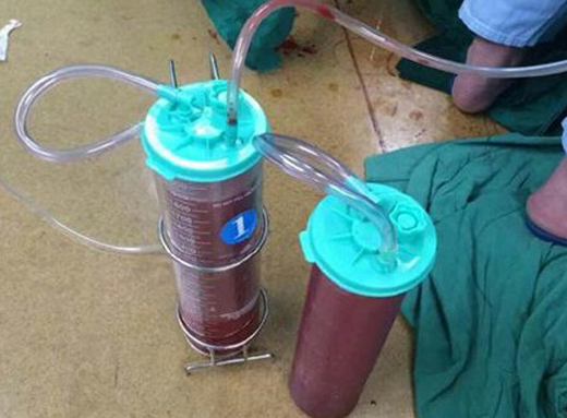 深圳公明广场砍人事件(图) 男子拿西瓜刀追砍他