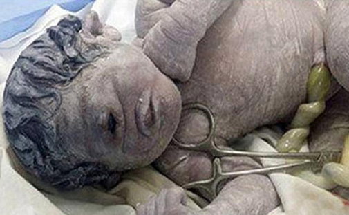  埃及婴儿一只眼睛 惊呆众人 或因受放射物影响