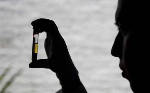 问题 疫苗 名单公布跟 假狂犬疫苗致死亡 有联系吗