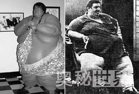 800斤第一胖手术（组图）世界上10大最肥胖的人都是谁谁谁？