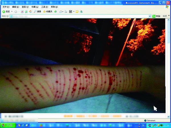 90后少女又爆\自残门\