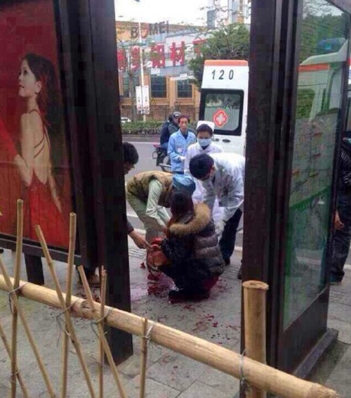 佛山女子公交站遇抢劫遭砍手 旁边小女孩被吓哭