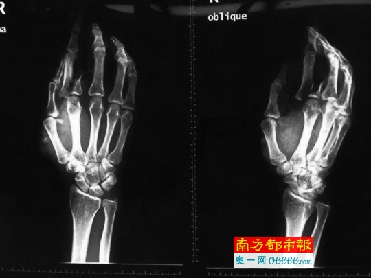 惠州一女医生被患者连砍数刀 未给砍人者看过