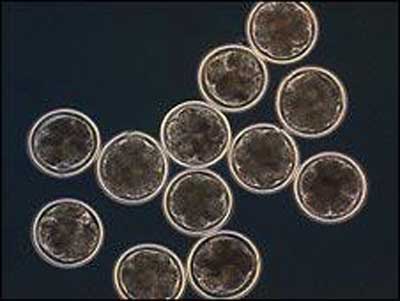 英国纽卡斯尔大学显微镜观察下的半人半兽混合胚胎。图片来源：BBC