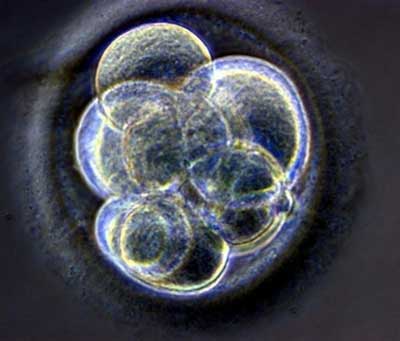 英国纽卡斯尔大学显微镜观察下的半人半兽混合胚胎。图片来源：法新社
