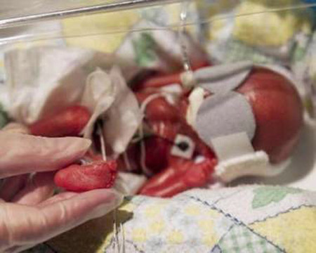 美妇女产下袖珍女婴 腿还没成人小指长