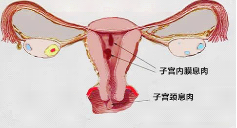 广州玛莱妇产医院宫颈LEEP术治疗优惠300元
