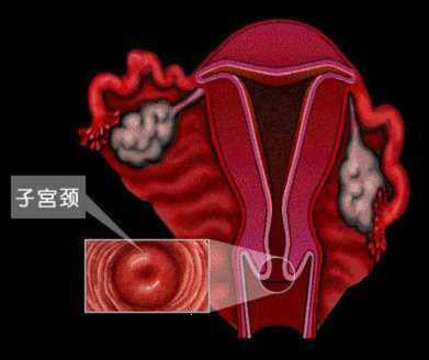 珠海博爱妇产医院网络预约治疗宫颈炎优惠多多