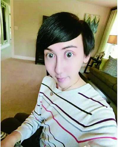 之前15岁女生整容爆红网络,最近还有一位男子(刘梓晨)更加厉害,整出