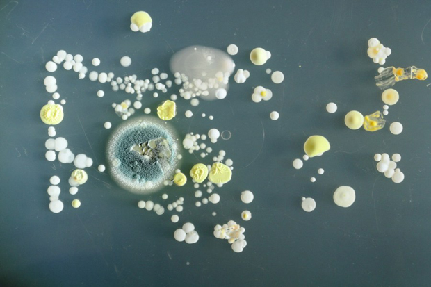 在手机上发现的另一种有害细菌是蕈状芽孢杆菌.